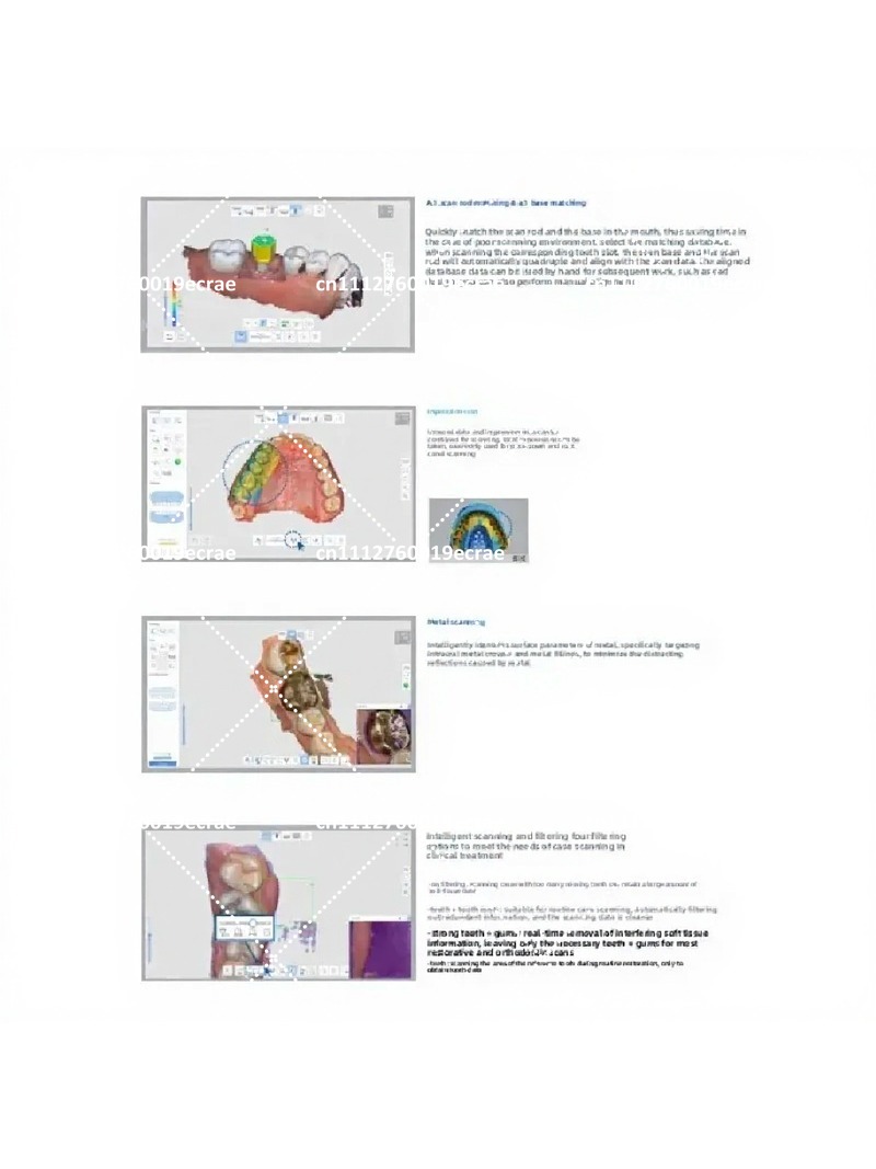High-Quality Intraoral Scanner - đánh giá và giá Outdoor Furniture Quality